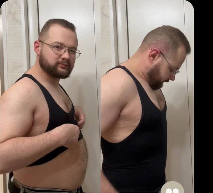 Antes e depois do João
