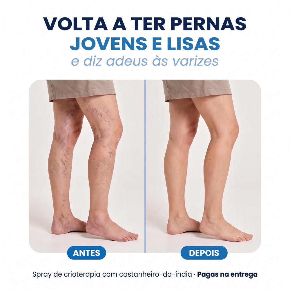 Antes e depois: pernas jovens e lisas sem varizes