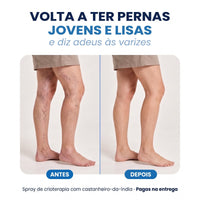 Antes e depois: pernas jovens e lisas sem varizes