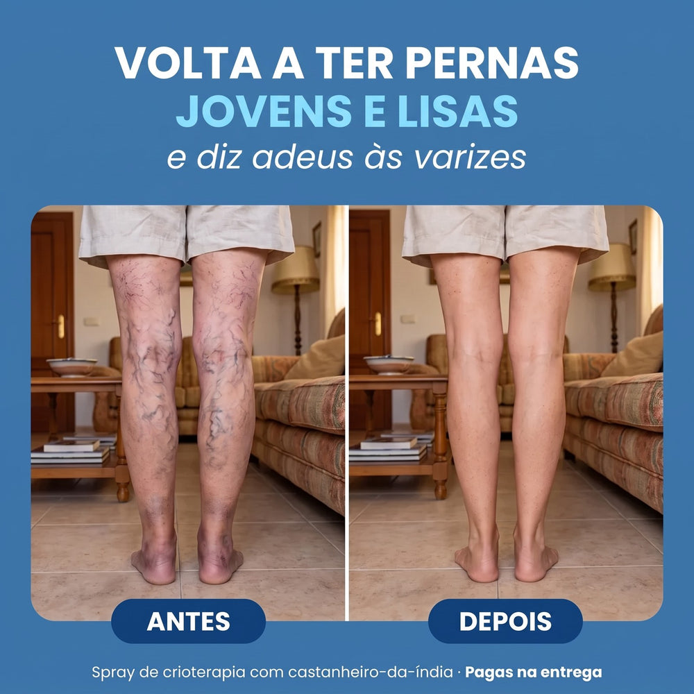 Antes e depois das varizes nas pernas