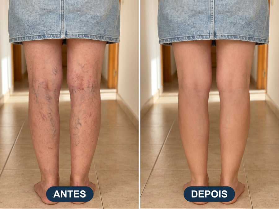 Vê como as tuas pernas passam de “cansadas e cheias de derrames” a