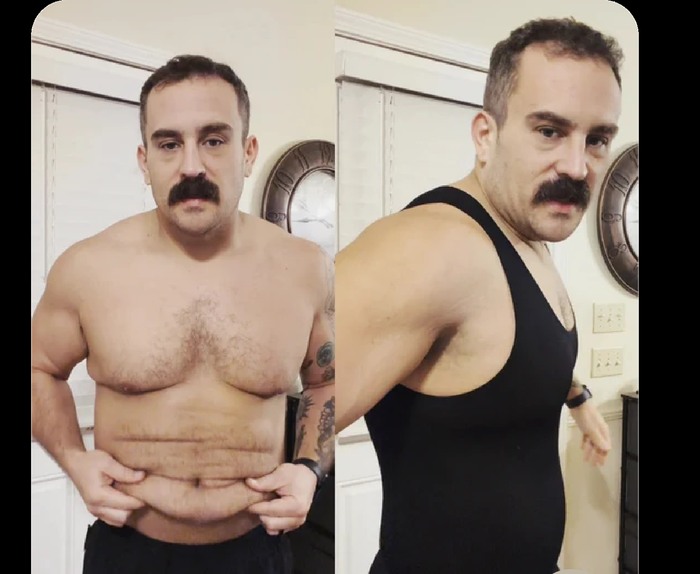 Antes e depois do Nuno