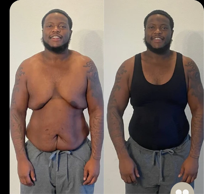 Antes e depois do Bruno