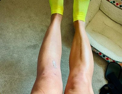 Vê como as tuas pernas passam de “inchadas e pesadas” a